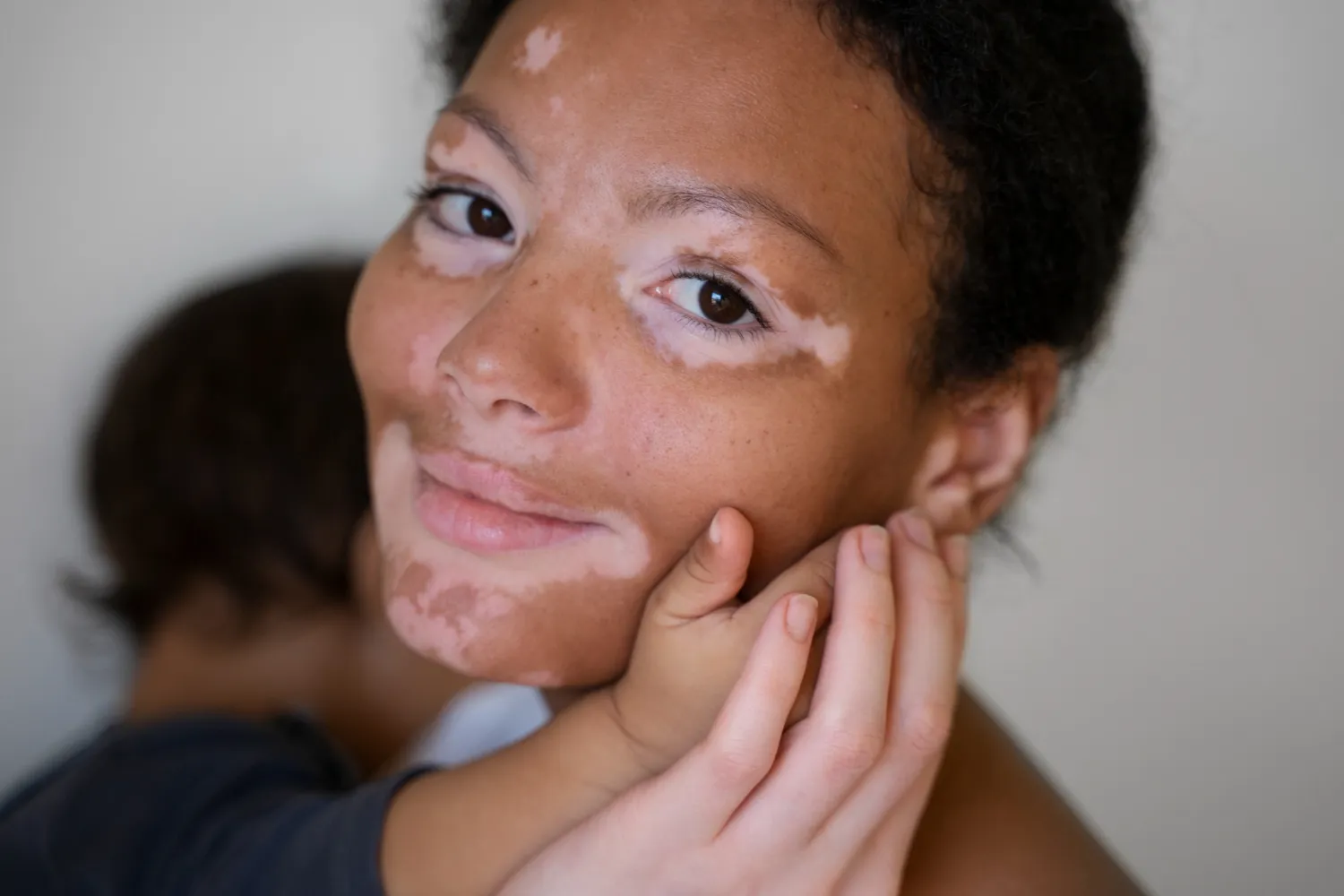 Descubre la belleza única de tu piel